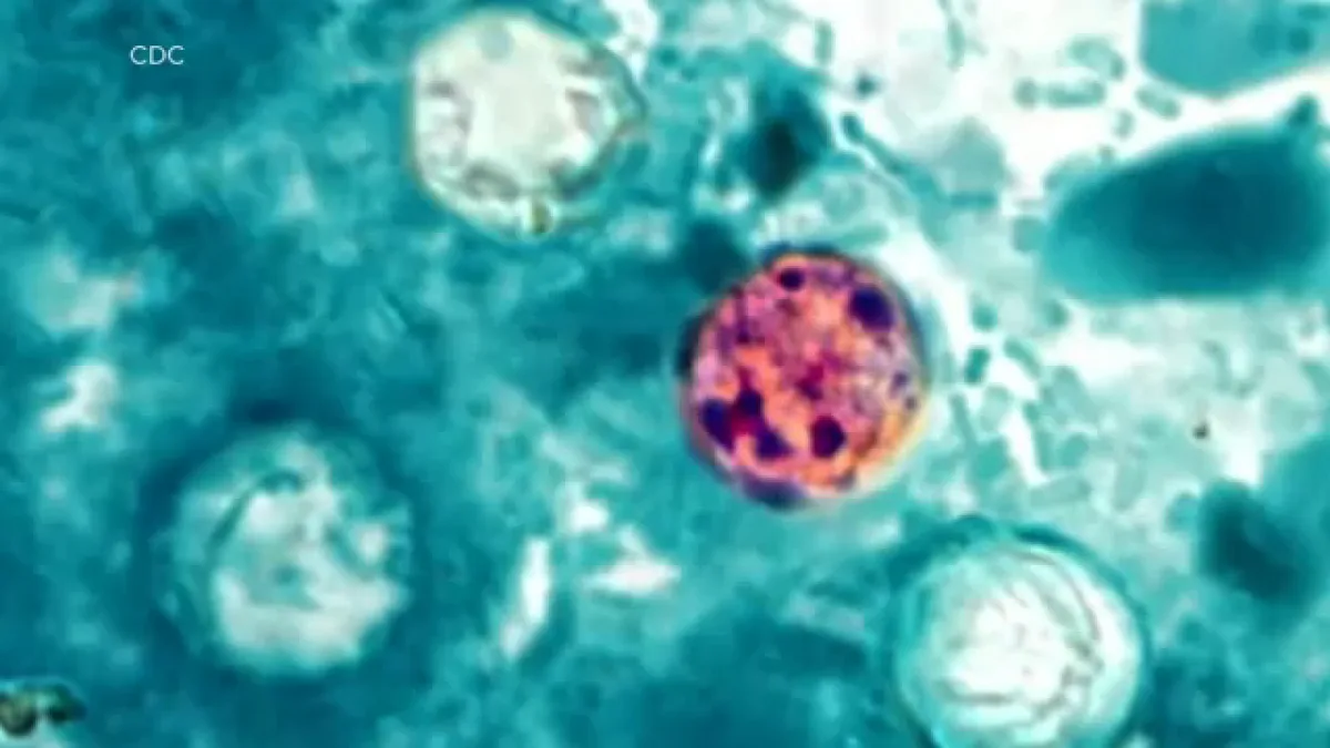 Galveston County health officials confirm 14 cyclosporiasis cases, 4 other under investigation