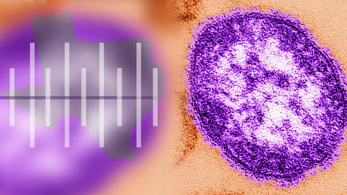 Montgomery County confirms 4th measles case - woman hospitalized