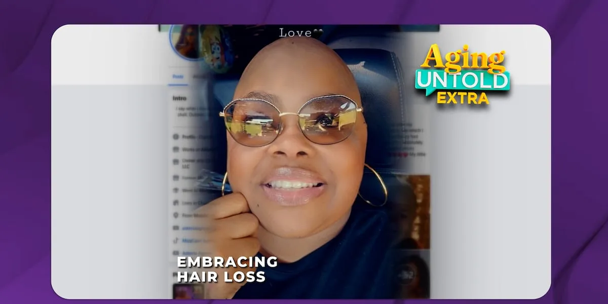 Influencer embraces hair loss from alopecia, encourages other women