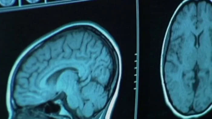 Dementia symptoms can begin in your 40s: What doctors want you to know