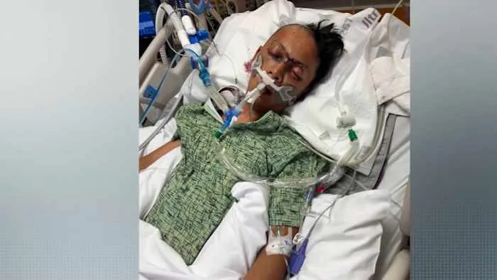 Family demands justice after man on life support after brutal attack along Highway 249