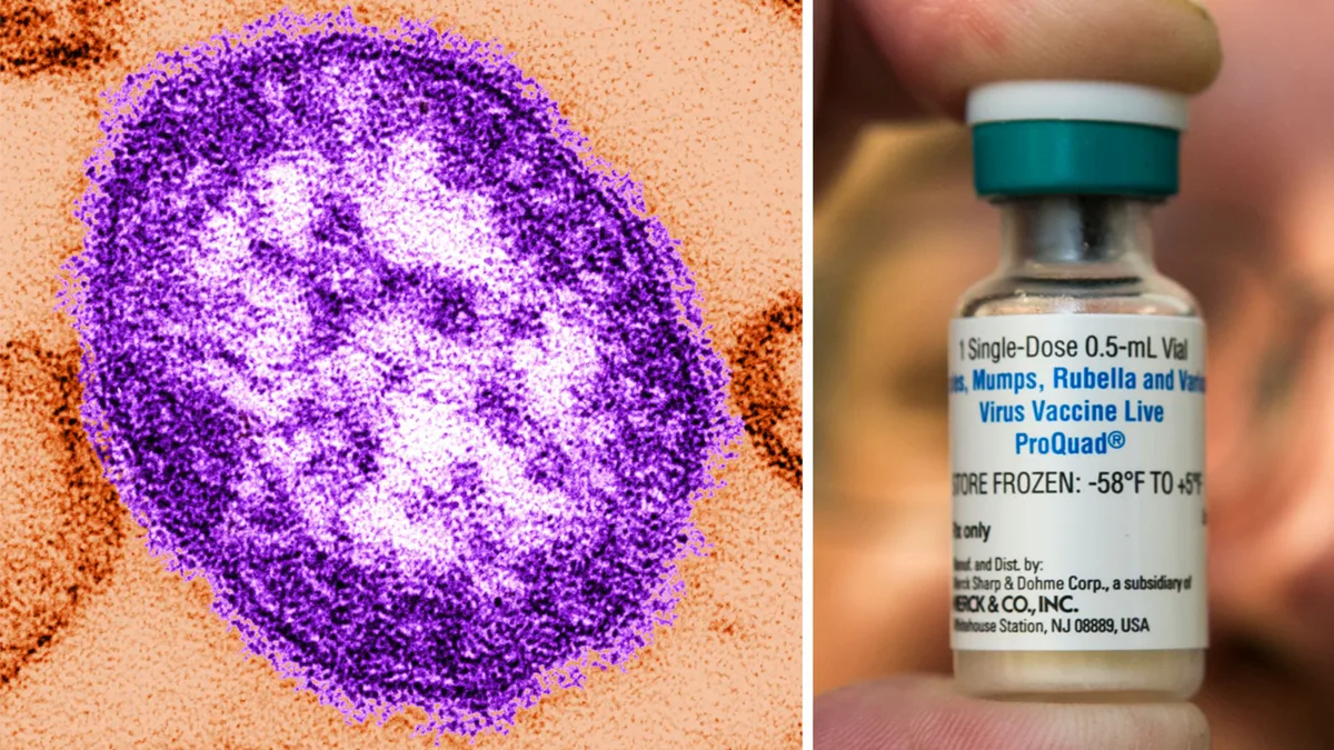 Texas DSHS issues health alert after 4 measles cases reported in Montgomery County