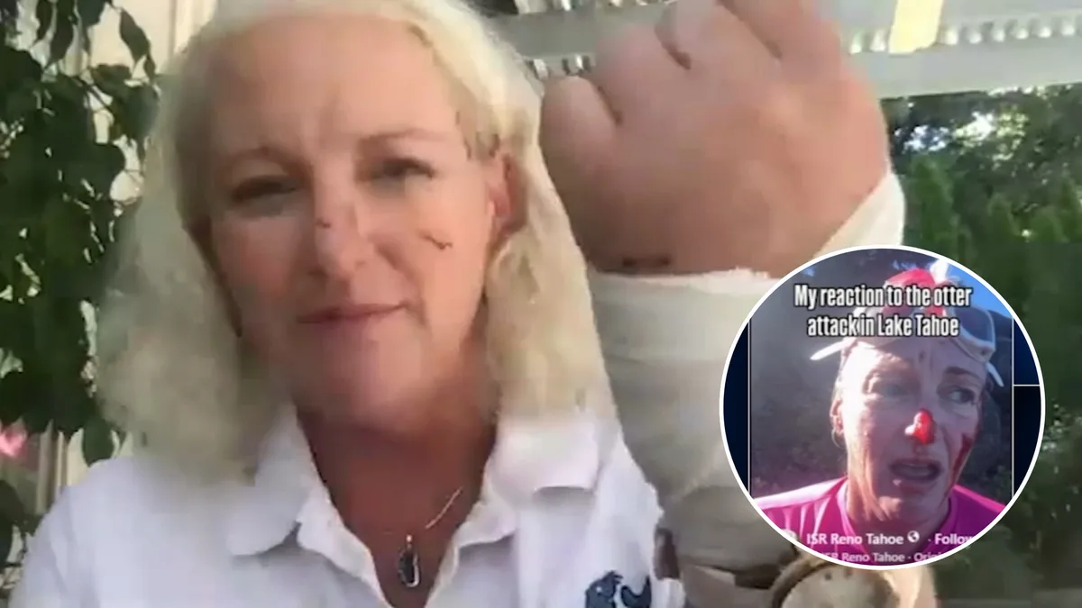 Woman attacked by otter while swimming says 'it felt like a human'
